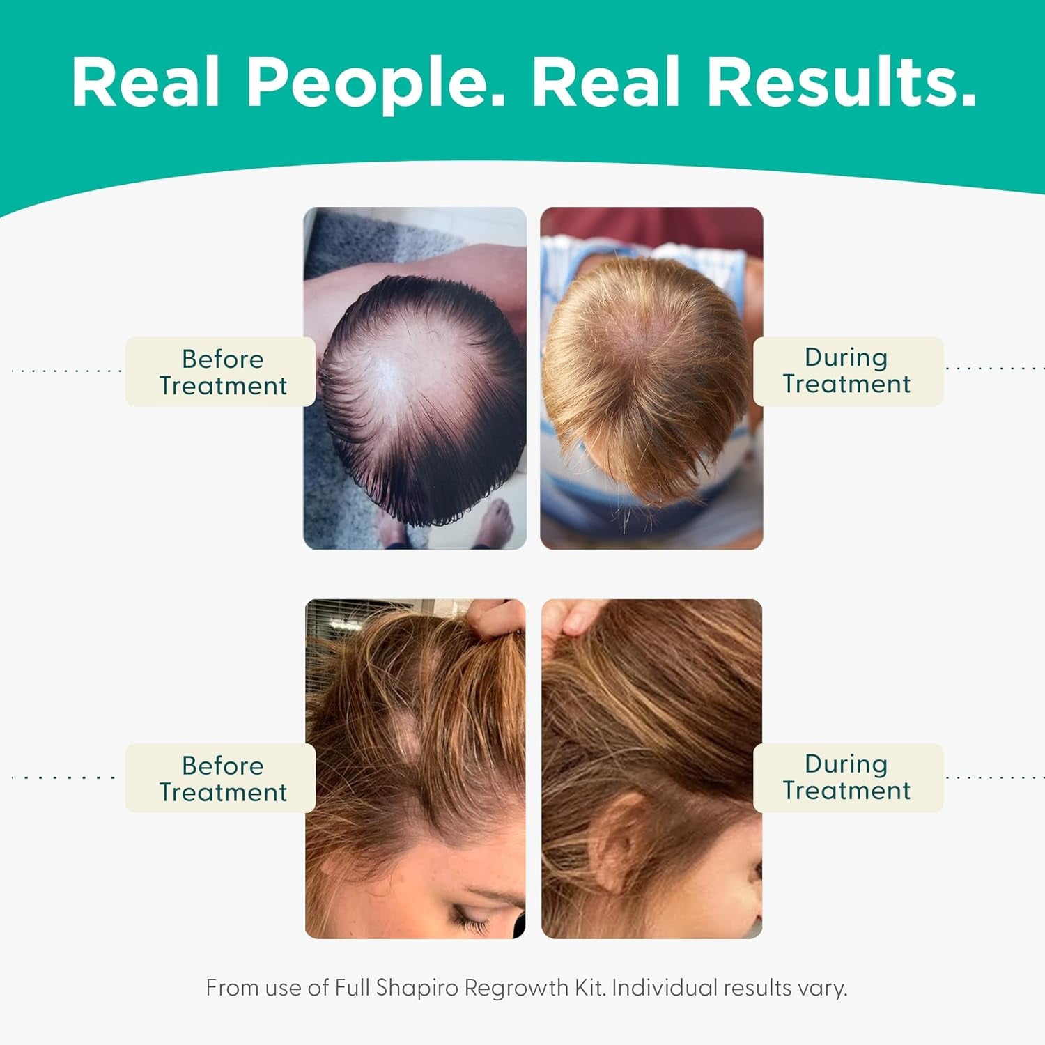 Experience Healthier, Fuller and Thicker Looking Hair (1 Month Supply)