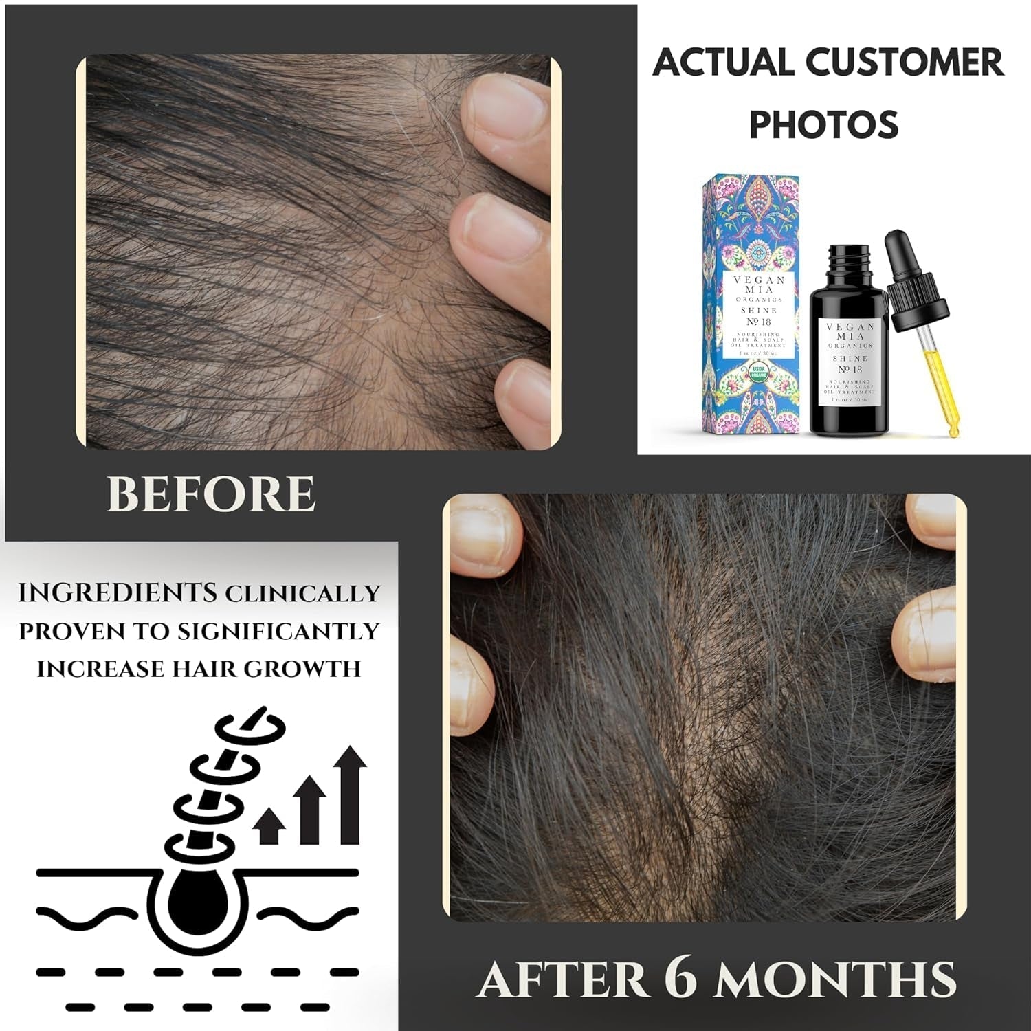 USDA Organic Rosemary Oil for Hair Growth with Castor Oil & More - Scalp Oil Treatment & Intense Nourishment to Get Healthier, Thicker & Shiny Hair Naturally, 1 Fl Oz Bottle